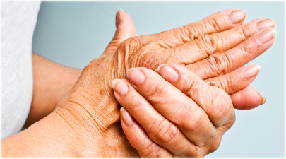 Physiotherapy For Arthritis adelaide